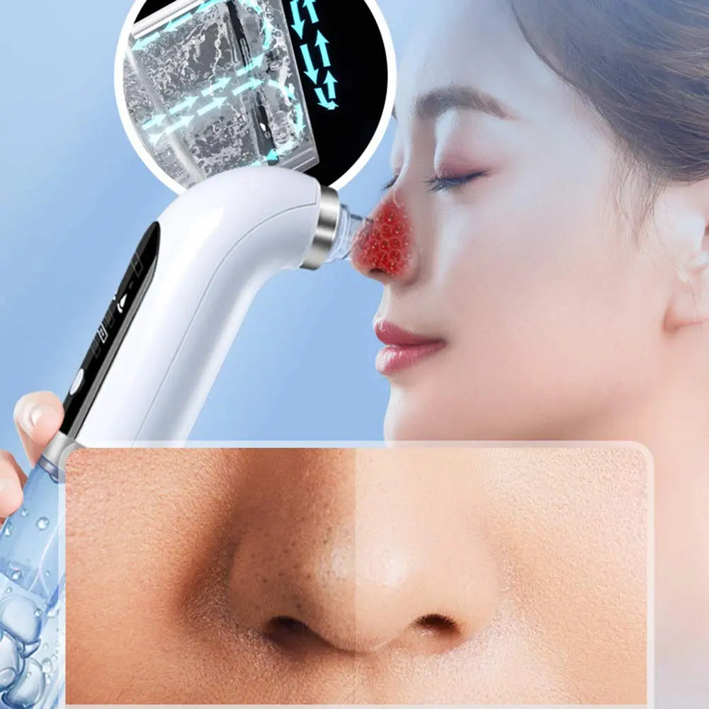 Aspirateur de Points Noirs Électrique – Nettoyeur de Peau ARMINE'S STYLE HUB